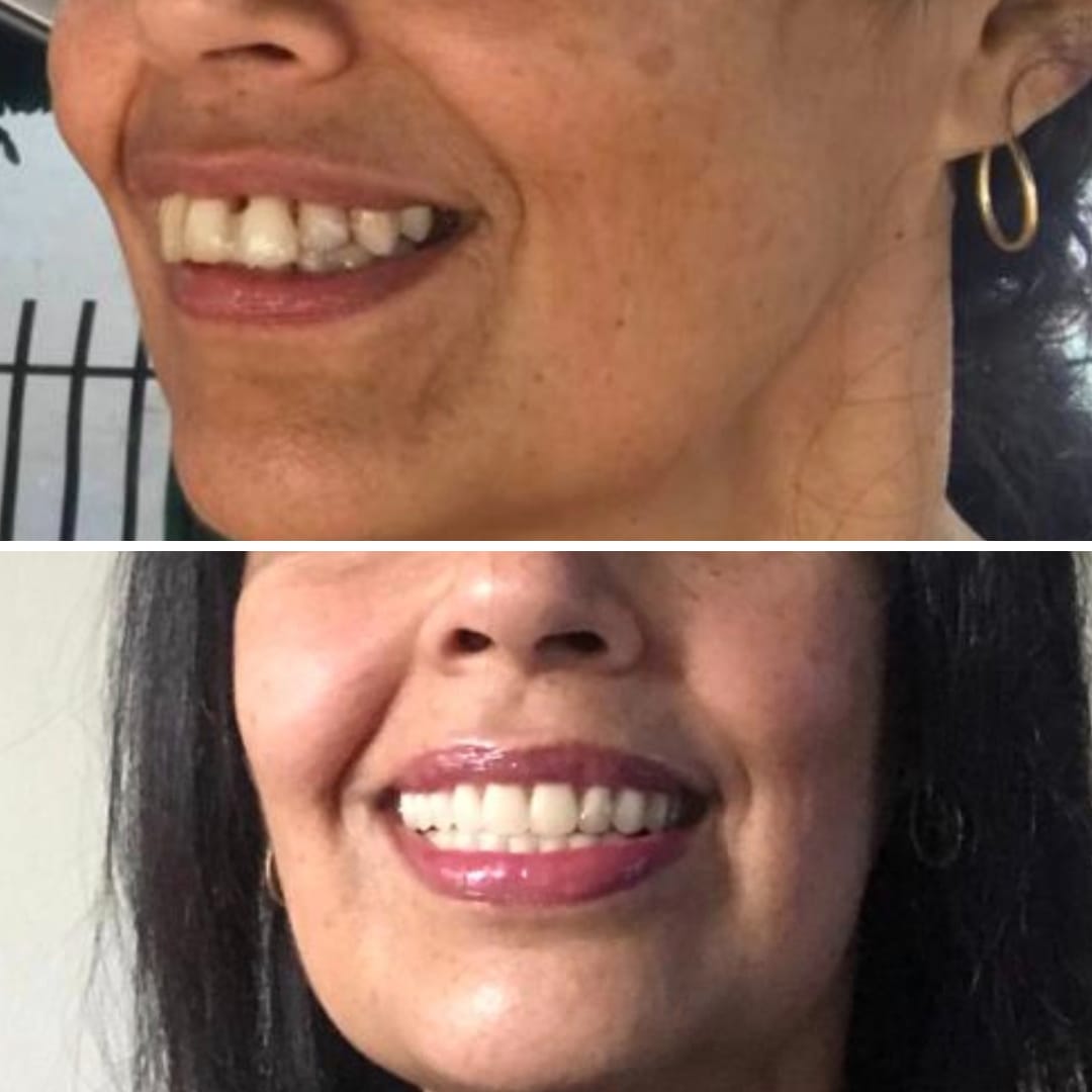 Imagem do WhatsApp de 2025-05-06 à(s) 11.03.12_26264c64